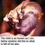 abortion09